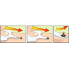 Мультитул для снятия клещей LIFESYSTEMS TICK REMOVER CARD